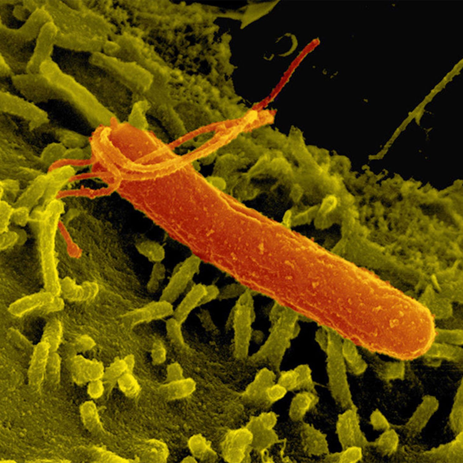 Helicobacter Pylori